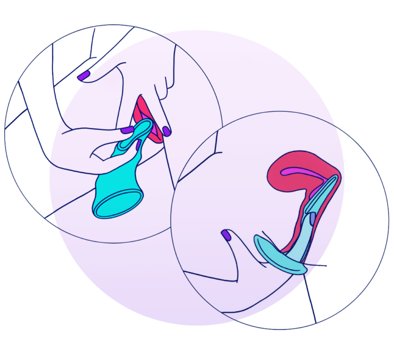 Illustration demonstrating how to insert FC2 Condom